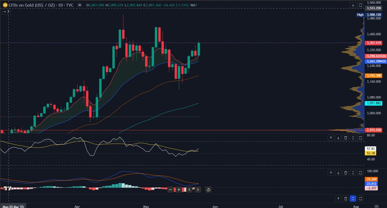 xauusd macro กราฟเทคนิค 2